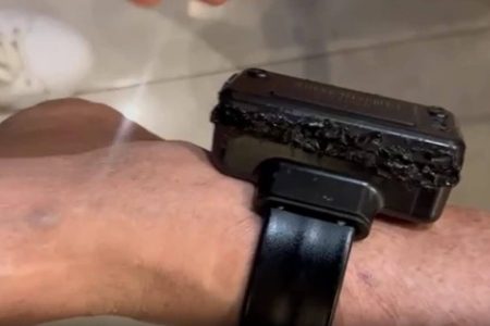  Bolsonaro admite ter usado solda quente para violar tornozeleira; veja como ficou equipamento