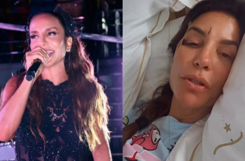  Após ser internada, Ivete Sangalo surge com rosto ferido e explica estado de saúde: ‘Caí com tudo’